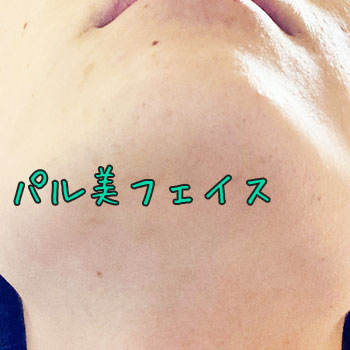 トリアを3ヶ月使用した男性の顔
